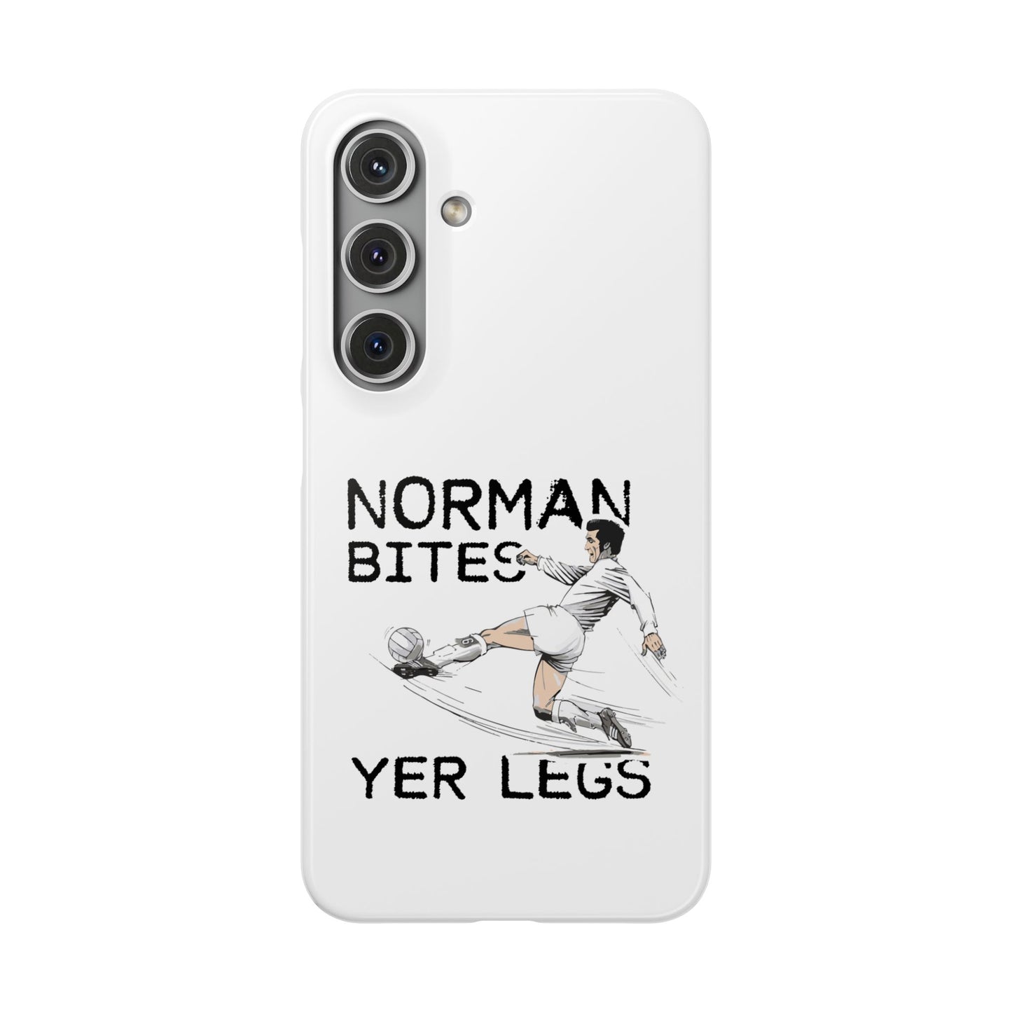 Leeds United Norman Bites "YER  LEGS" Snap Case
