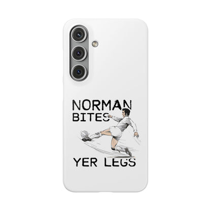 Leeds United Norman Bites "YER  LEGS" Snap Case
