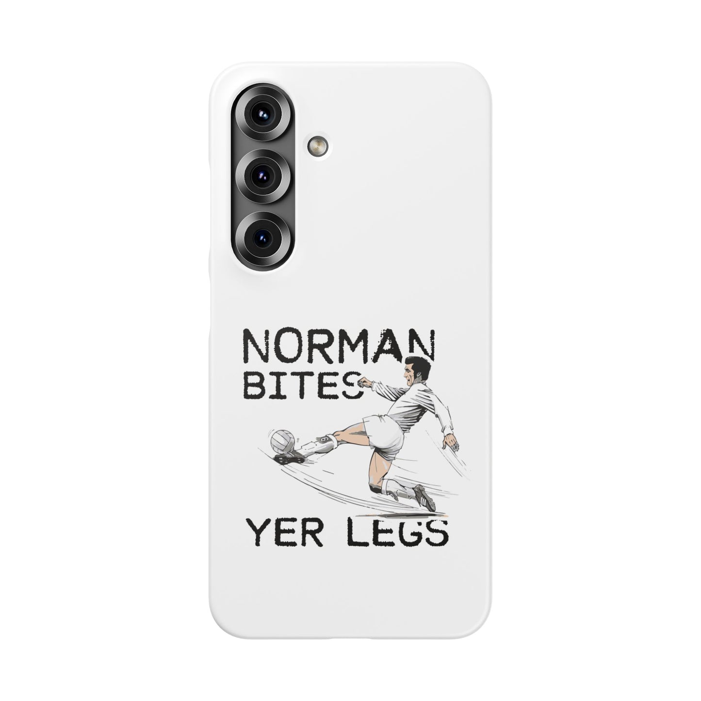 Leeds United Norman Bites "YER  LEGS" Snap Case