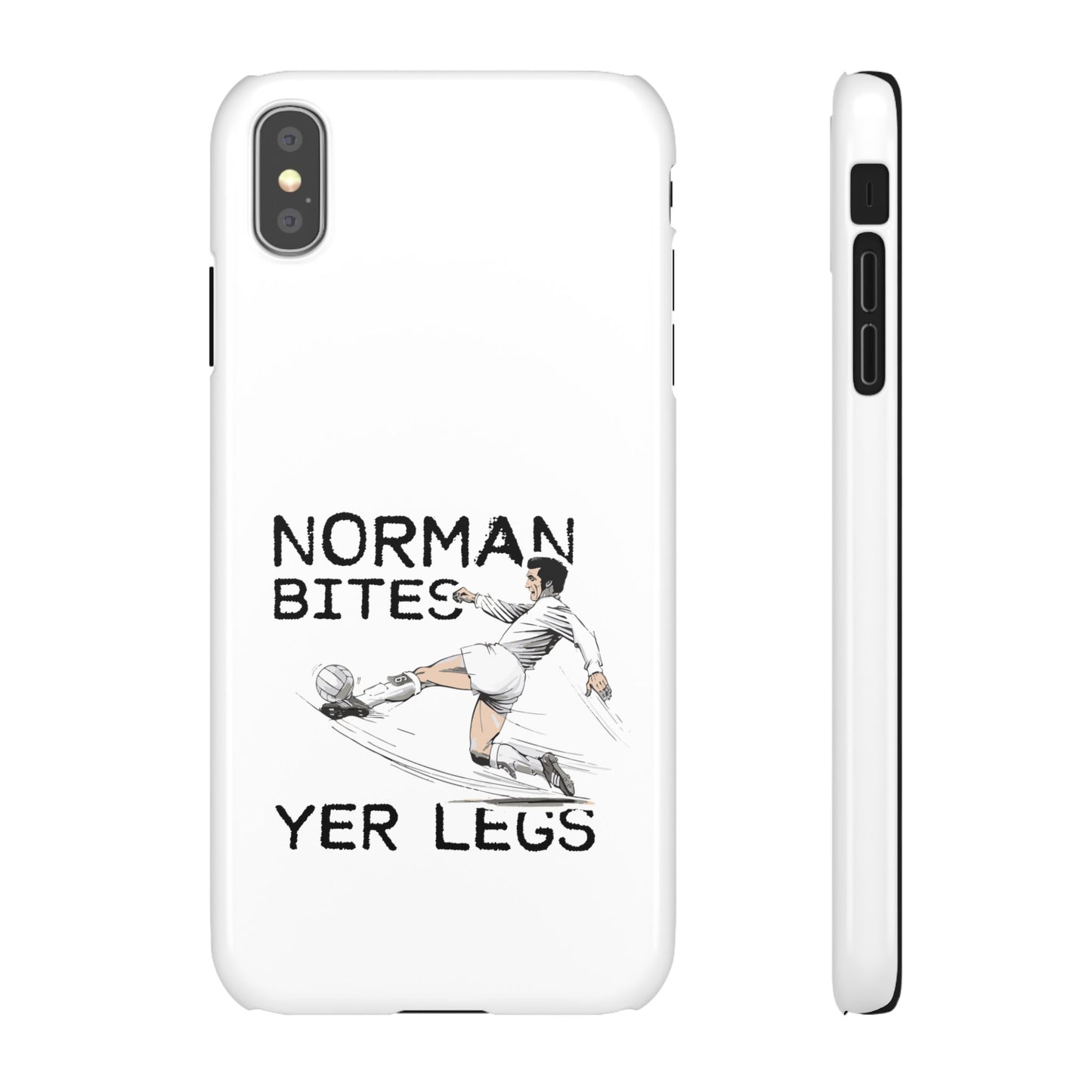 Leeds United Norman Bites "YER  LEGS" Snap Case