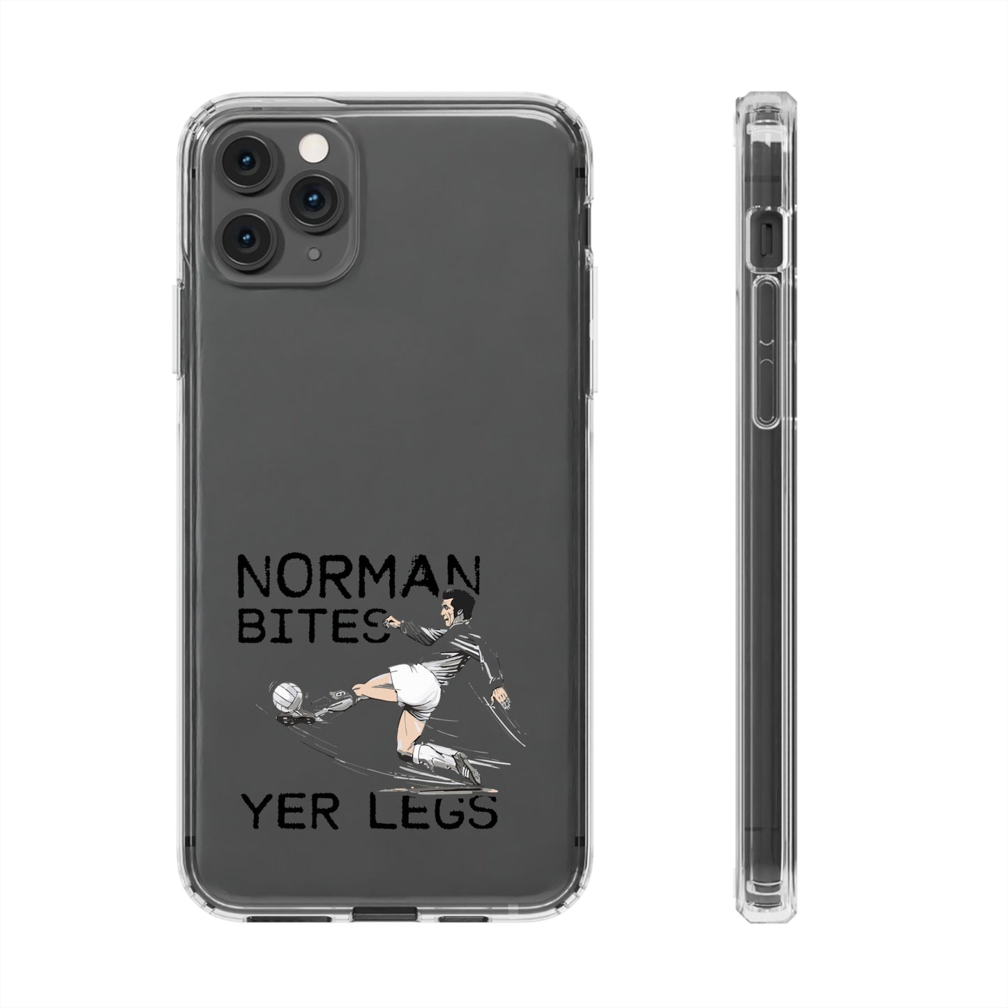 Leeds United Norman Bites 'YER  LEGS' Clear Impact-Resistant Case