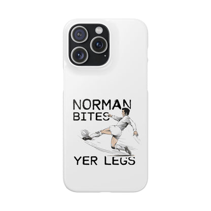 Leeds United Norman Bites "YER  LEGS" Snap Case